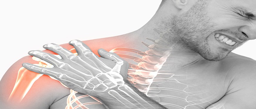 fractura clavicula clinica internacional