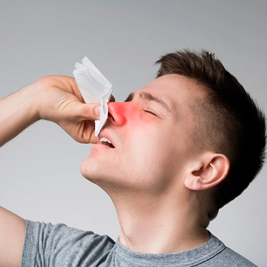 por que sangro por la nariz